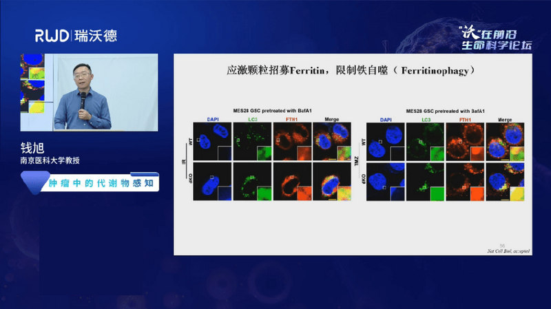 qian-xu-glioma-metabolism-fumarate-succinylation-iron-metabolism.jpg